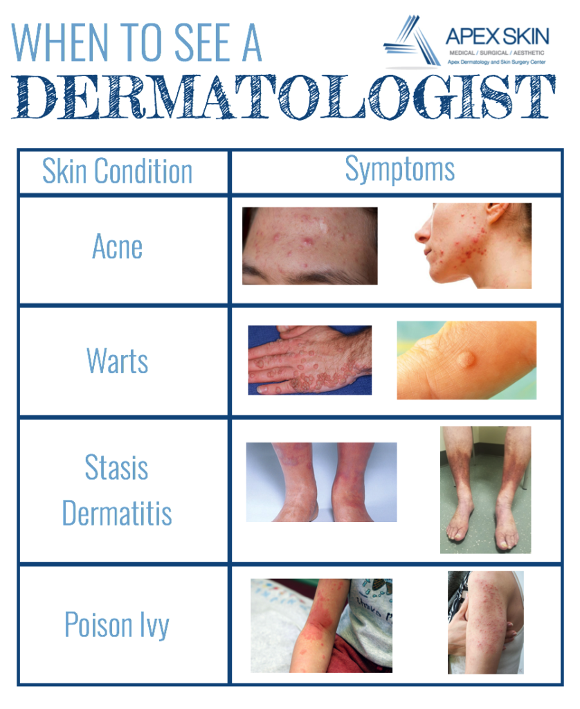 when to see a dermatologist