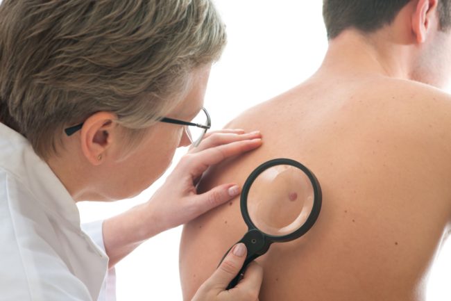 how-to-spot-skin-cancer how-to-spot-skin-cancer