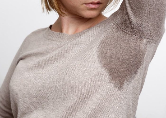 hyperhidrosis hyperhidrosis