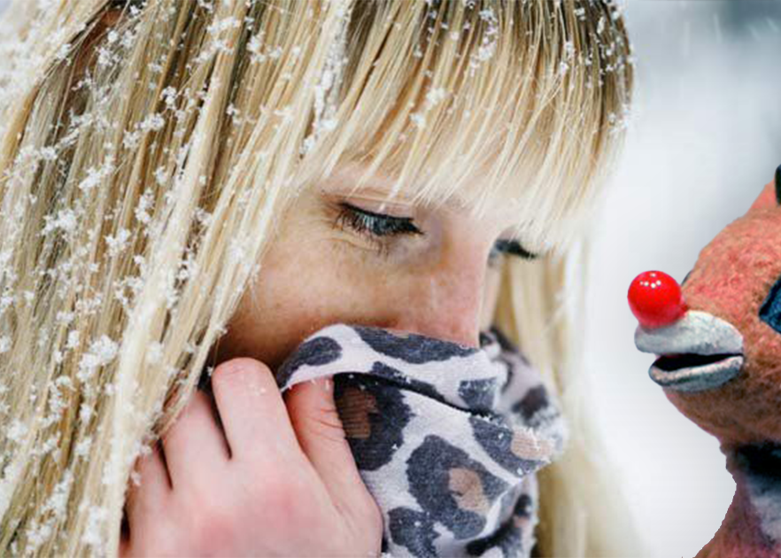 rosacea winter