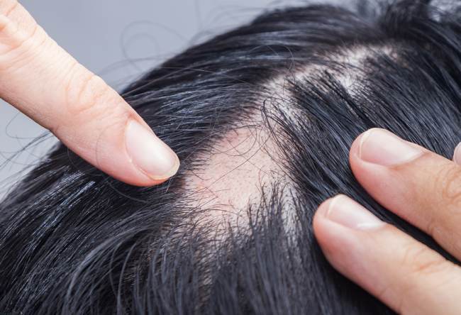 auto immune diseases auto immune diseases