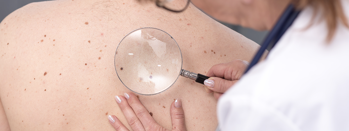 full body skin check