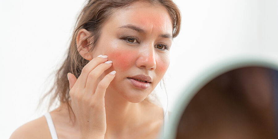 Sun Damage Treatment Dermatologist Ohio