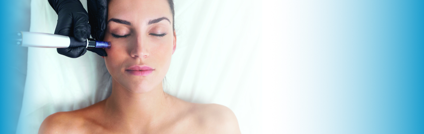 Microneedling Treatment