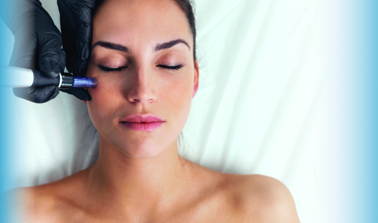 Microneedling Treatment