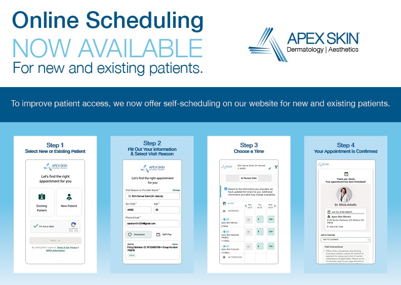 Apex online scheduling