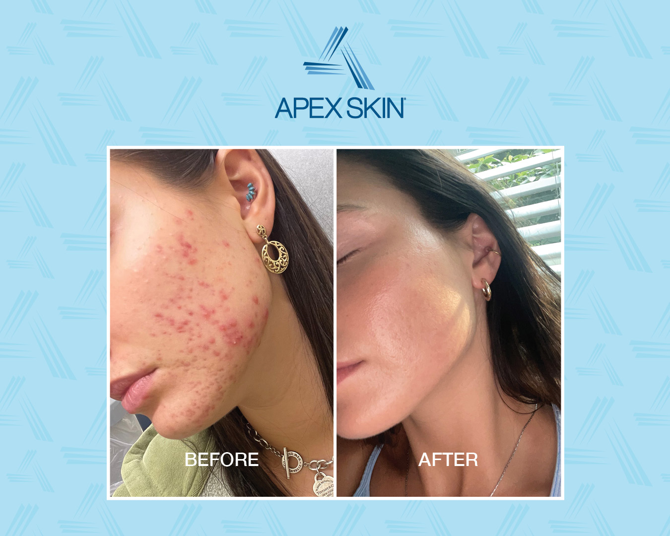 Patient Before After