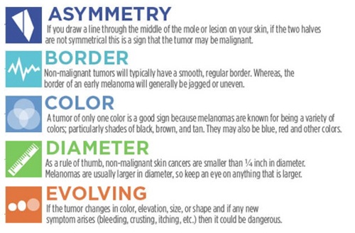 5-skin-cancer-questions-answers