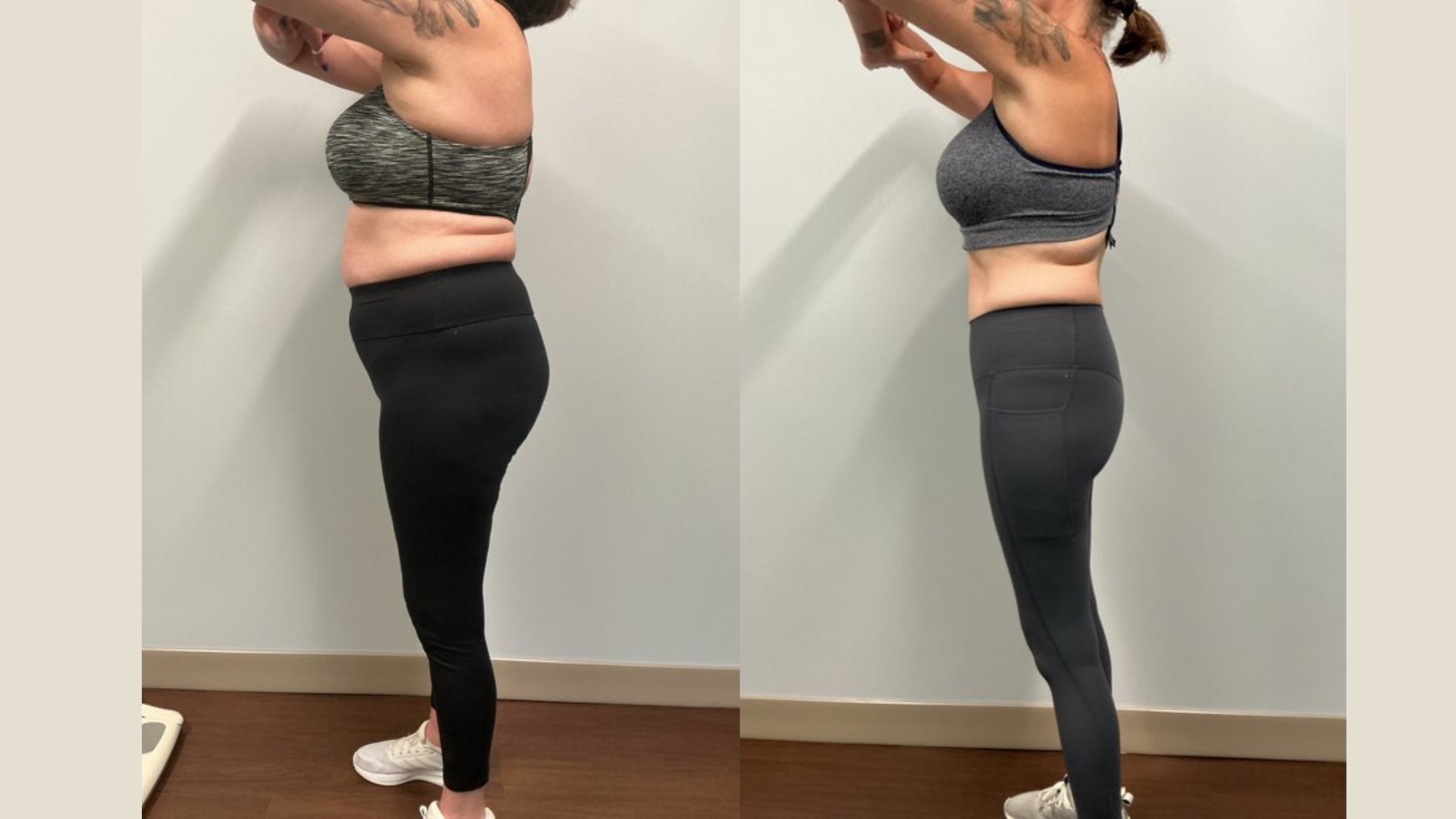 One patient's journey using GLP-1s to support menopause. Before and after GLP-1s for menopause.