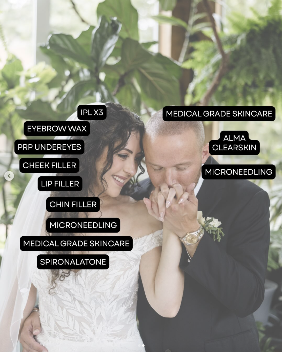 Skincare routine to prepare for wedding at Apex bride and groom