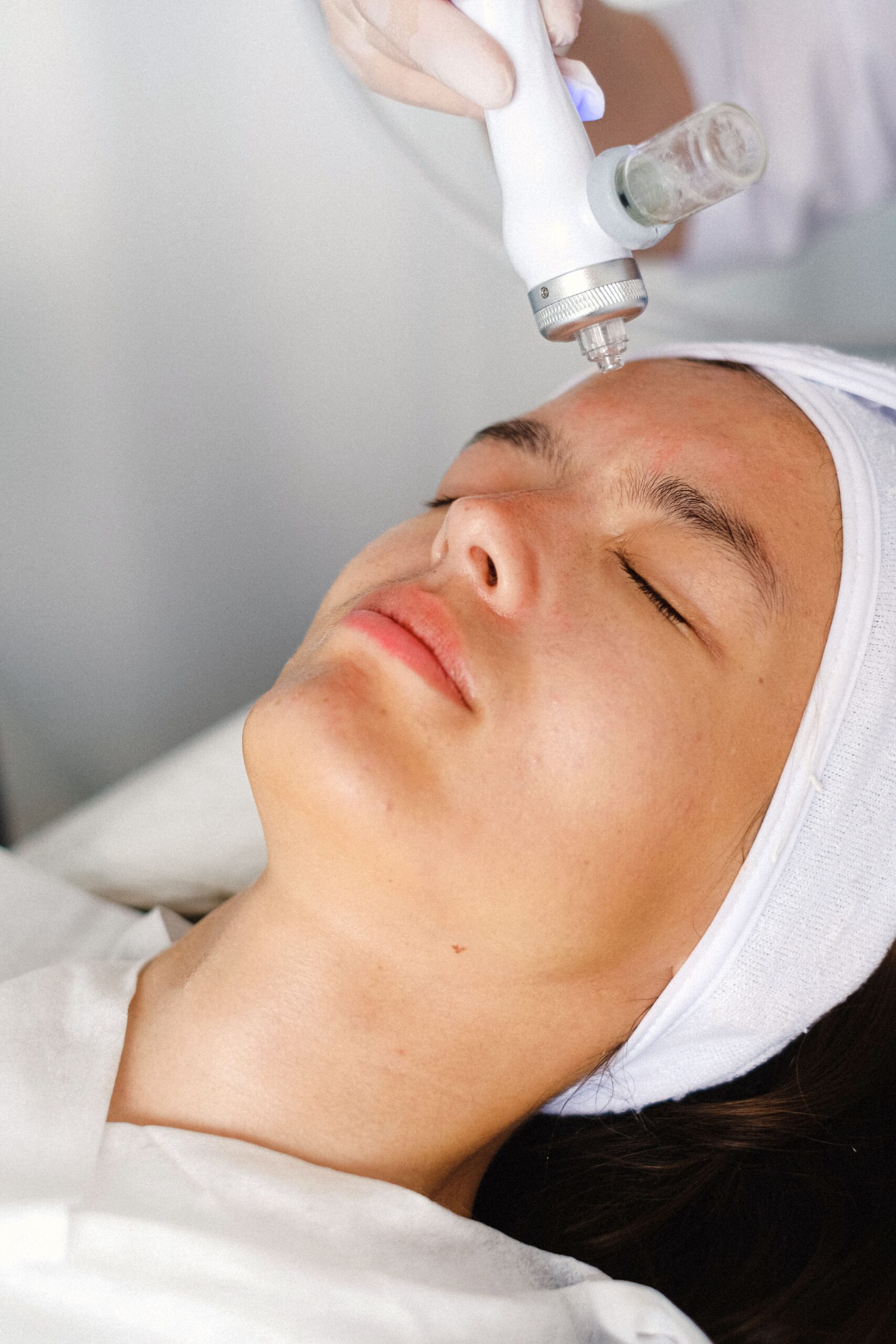 Woman at microneedling appointment
